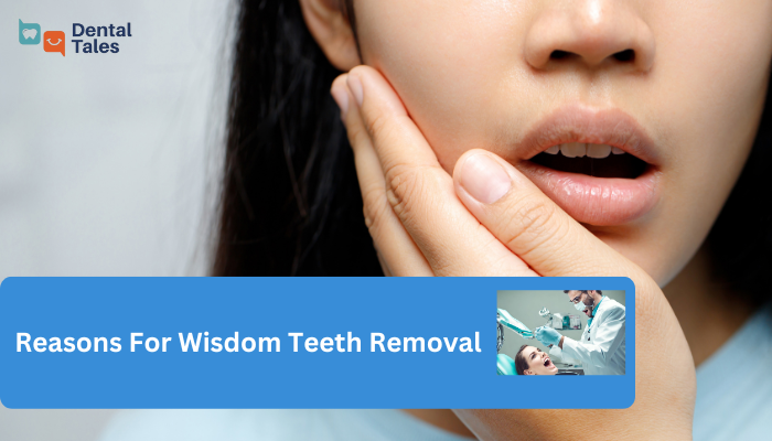 Wisdom Teeth Removal Featured Image