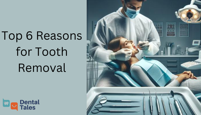 Top 6 Reasons for Tooth Removal