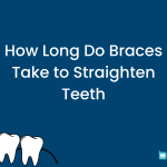 How Long Do Braces Take to Straighten Teeth