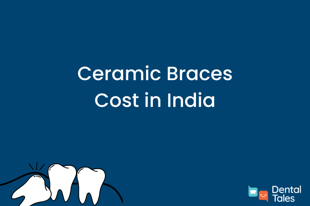 Ceramic Braces Cost in India