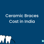 Ceramic Braces Cost in India